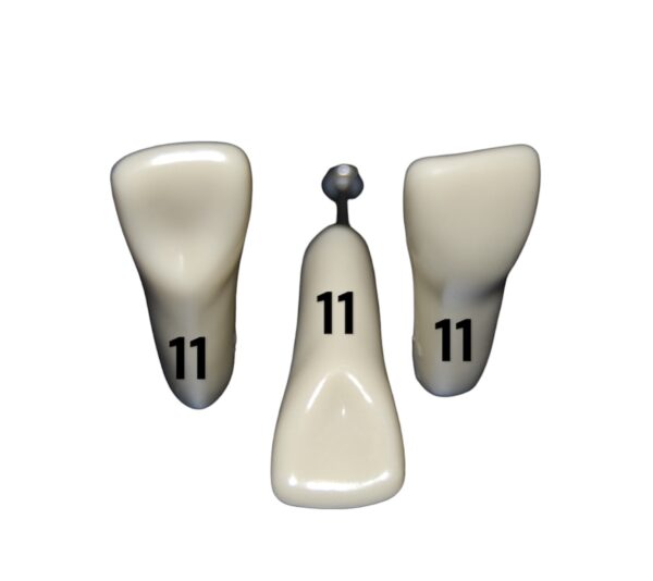 Tooth 11