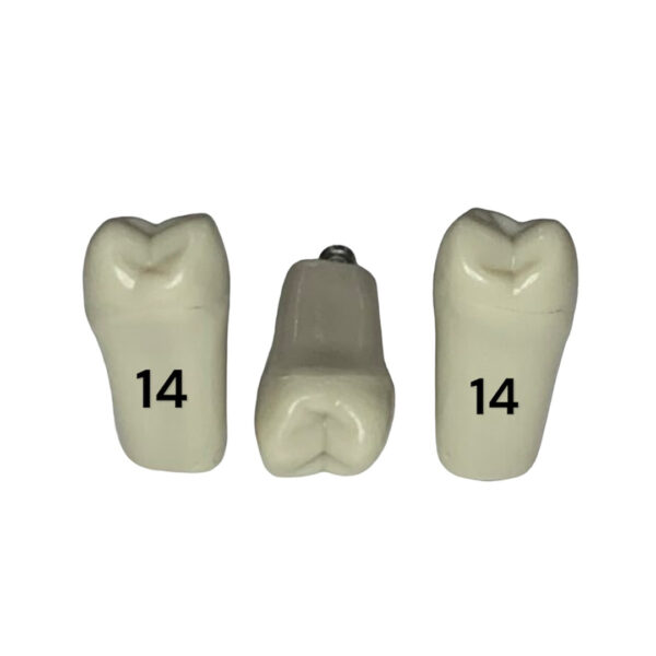 Tooth 14