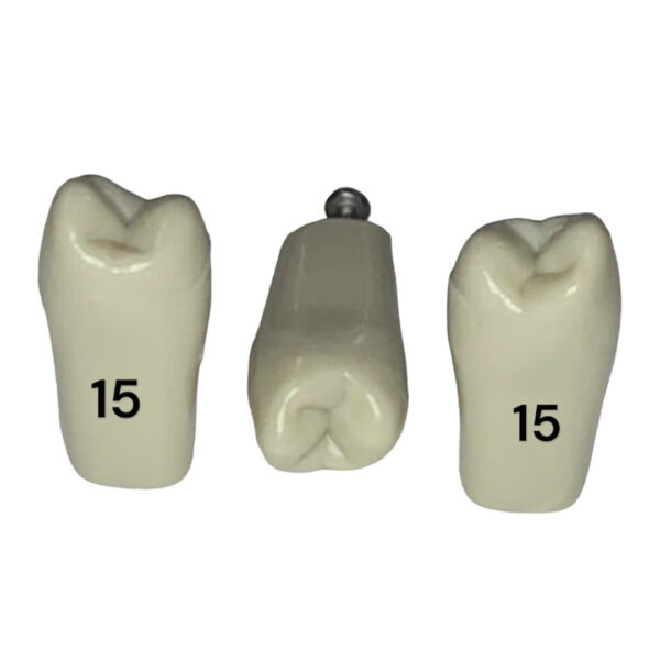 Tooth 15