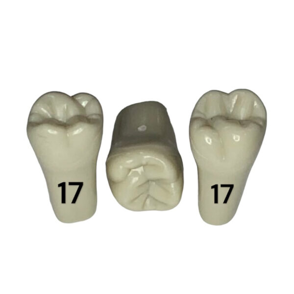 Tooth 17