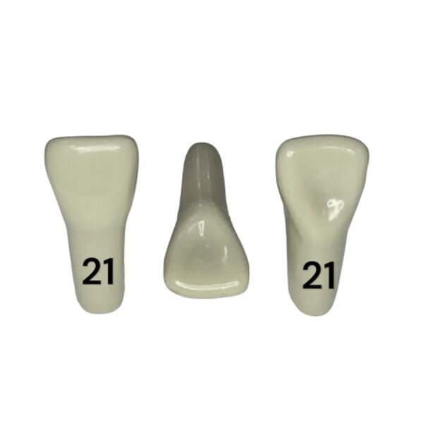 Tooth 21