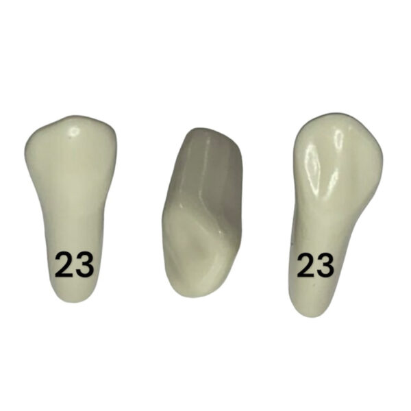 Tooth 23