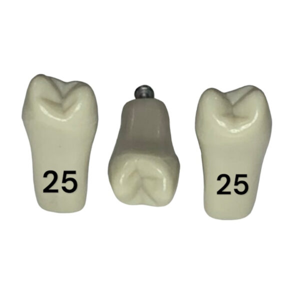 Tooth 25