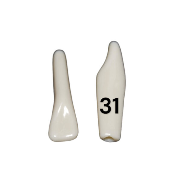 Tooth 31