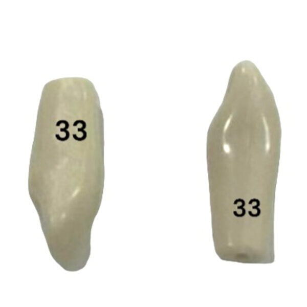 Tooth 33