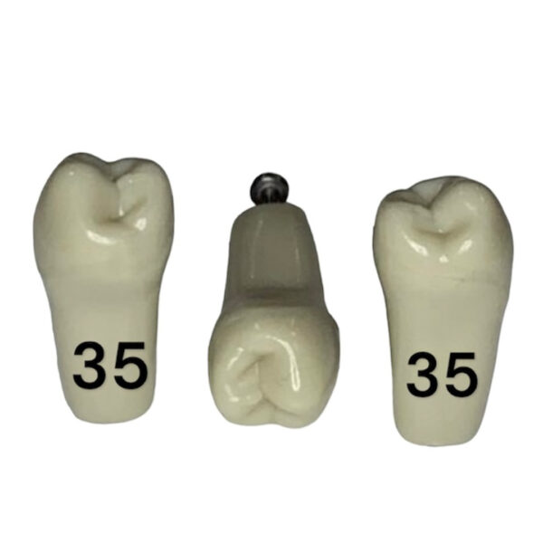 Tooth 35