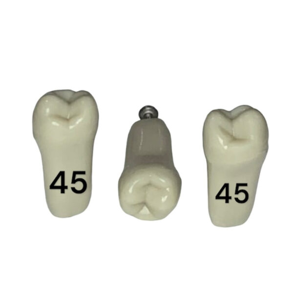 Tooth 45