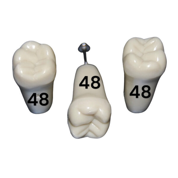 Tooth 48