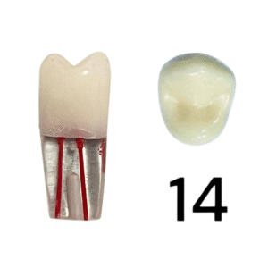 Endo Teeth