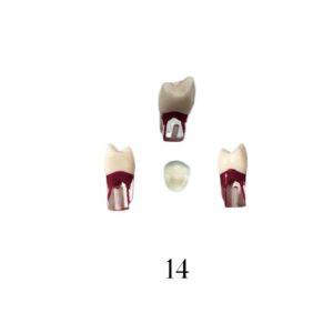 Endo Tooth 14