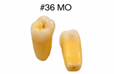 Caries Teeth 36 MO Connected